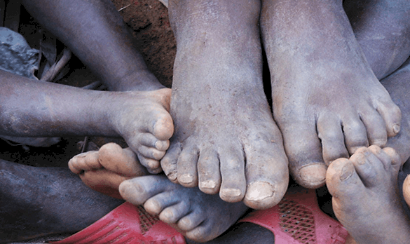 Shoe Donation Program
